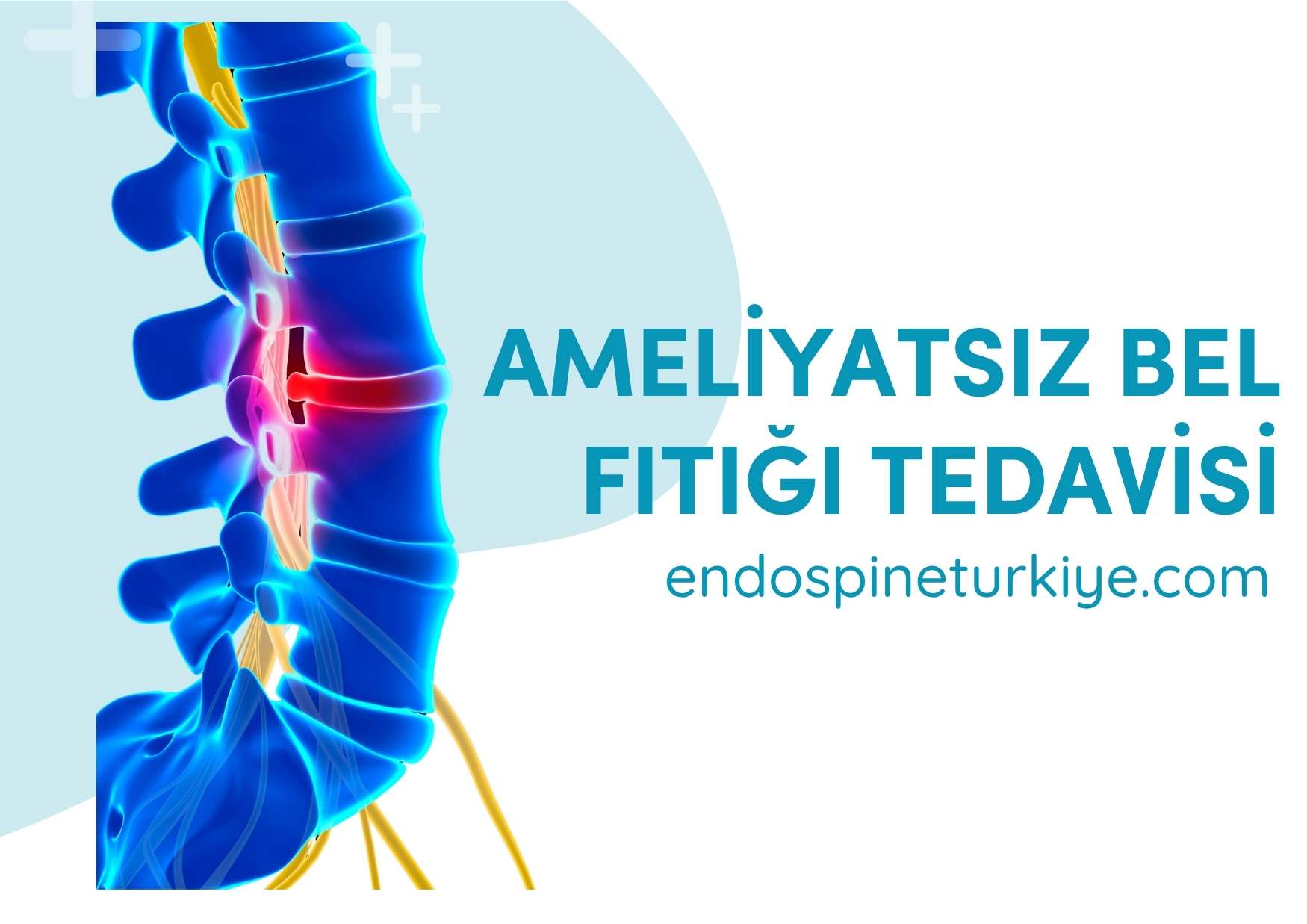 Ameliyatsız bel fıtığı tedavisi - fizik tedavi ve rehabilitasyon