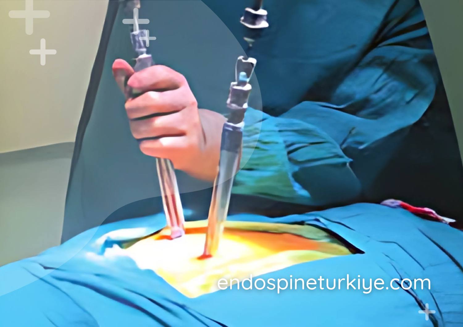 Perkütan vida simülasyon - minimal invaziv stabilizasyon tekniği